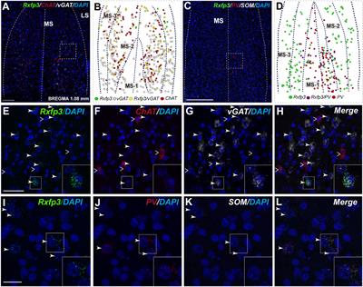 GABAergic Neurons in the Rat Medial Septal Complex Express Relaxin-3 Receptor (RXFP3) mRNA